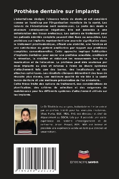 Prothèse dentaire sur implants 