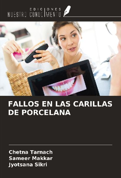 FALLOS EN LAS CARILLAS DE PORCELANA