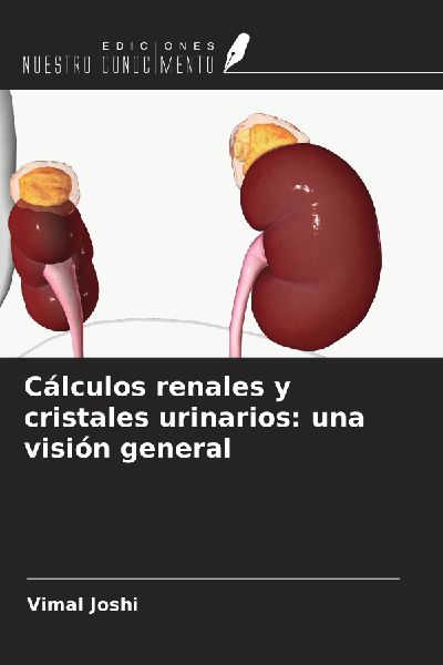 Cálculos renales y cristales urinarios: una visión general